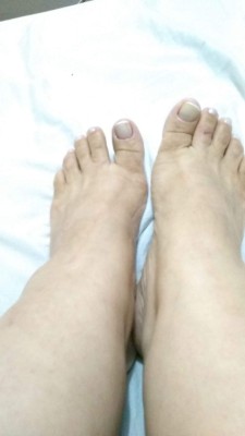 Coroa