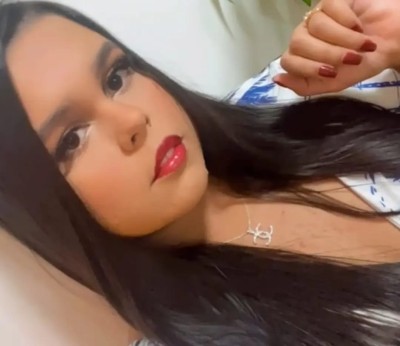 Atendimento sem frescura com anal