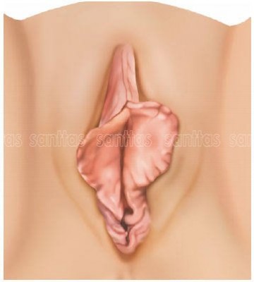 Procuro mulheres com pequenos lábios vaginais avantajados