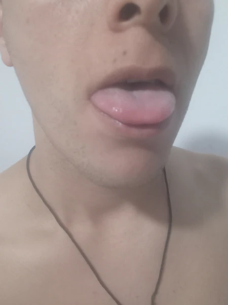 Moreno Simpático 